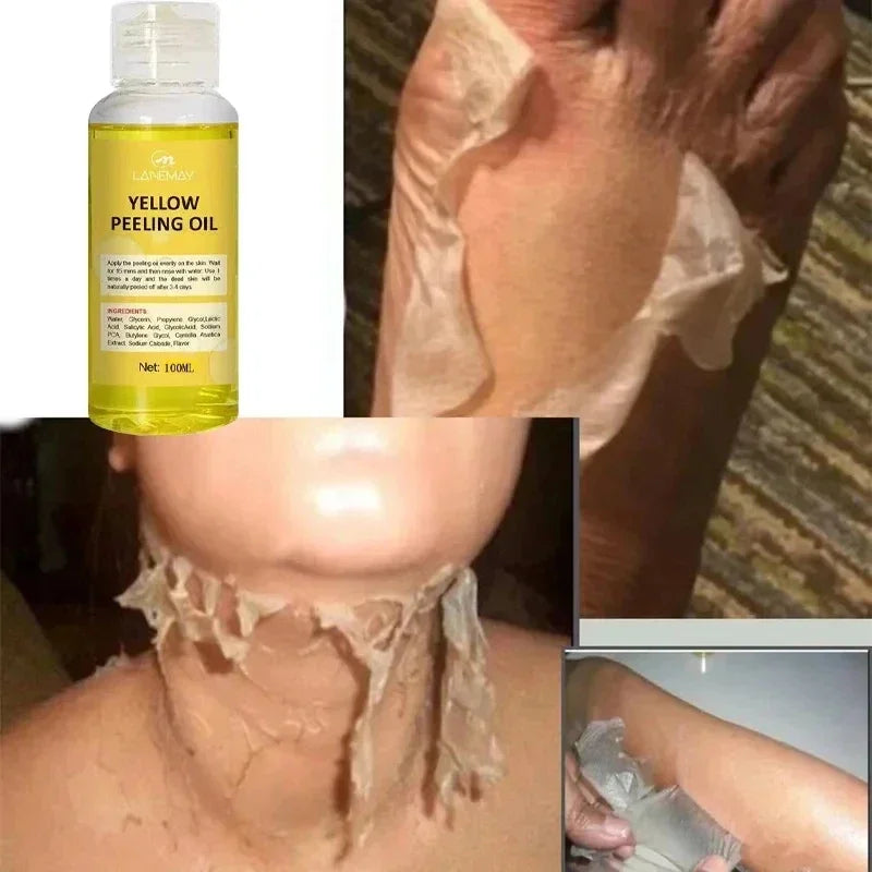 Body Care Exfoliating Yellow Peeling Oil – 100% Organic Dark Skin Whitening Serum for Dark Knuckles and Fast Bleaching