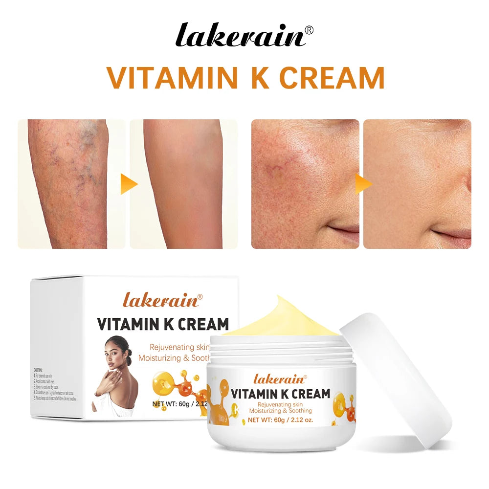 Vitamin K Leg Care Cream - Soothing Massage Cream for Tired Legs, Varicose Vein & Spider Vein Appearance Support