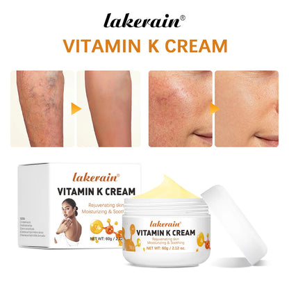 Vitamin K Leg Care Cream - Soothing Massage Cream for Tired Legs, Varicose Vein & Spider Vein Appearance Support