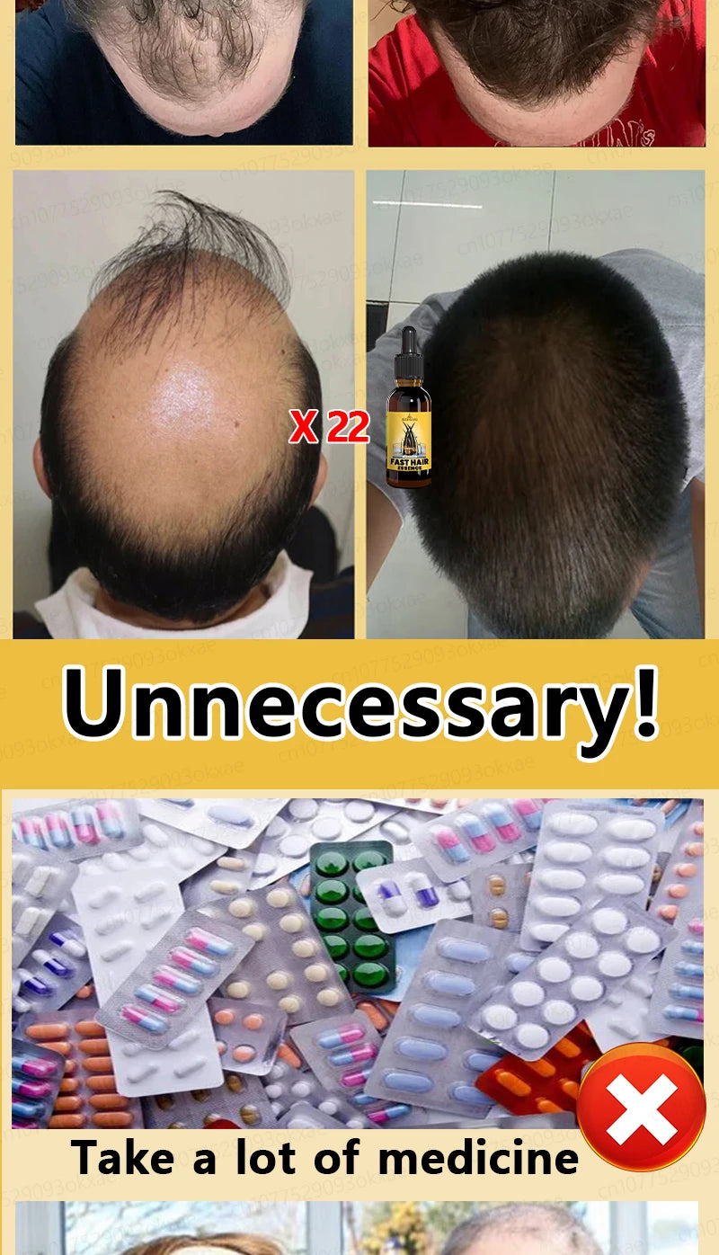 Rapid Hair Growth Serum – Beard, Chest & Body Hair Enhancer for Fuller, Thicker Growth