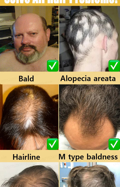 Rapid Hair Growth Serum – Beard, Chest & Body Hair Enhancer for Fuller, Thicker Growth