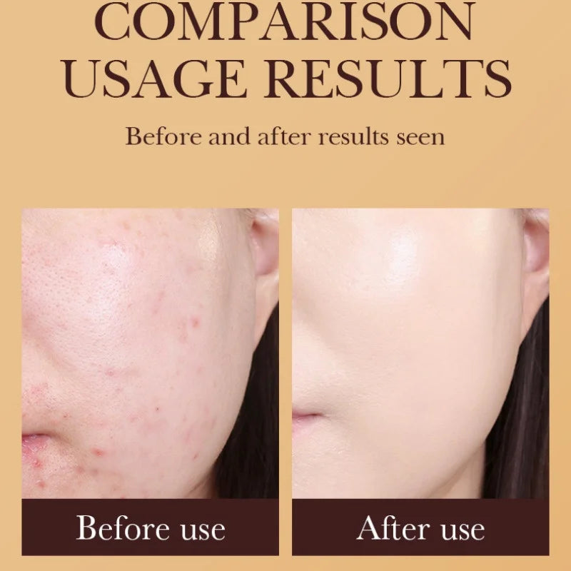 SADOER Gold Snail BB Cream — Oil-Control Matte Foundation & Concealer SPF50+ PA+++ 40g