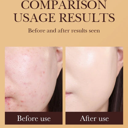 SADOER Gold Snail BB Cream — Oil-Control Matte Foundation & Concealer SPF50+ PA+++ 40g