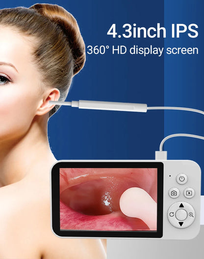 DDCAMERA 4.3" Digital Otoscope – 1080P Ear Scope with 6 LED Lights for Ear Wax Removal, Photo & Video Support