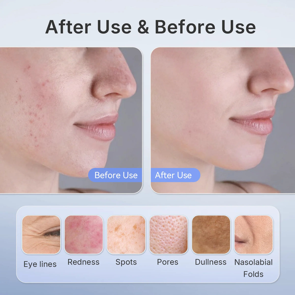 Hello Face Red & Near-Infrared Light Mask - Wireless Ultra-Light Facial Mask for Professional-Style Skincare