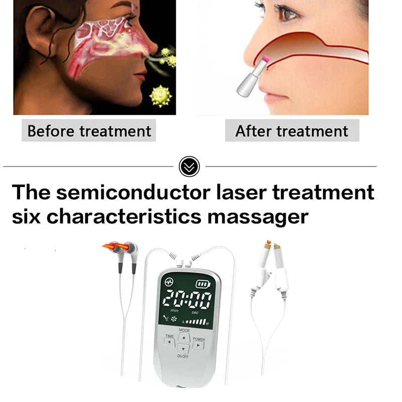 Portable Tinnitus Ear Laser Therapy – 650nm LLLT Irradiation Earplugs for Otitis Media, Deafness, Rhinitis & Sinusitis Treatment