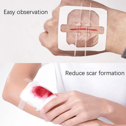 Camping Wound Closure Strips – Painless Adhesive Suture Patch for Fast Hemostatic Care & First Aid