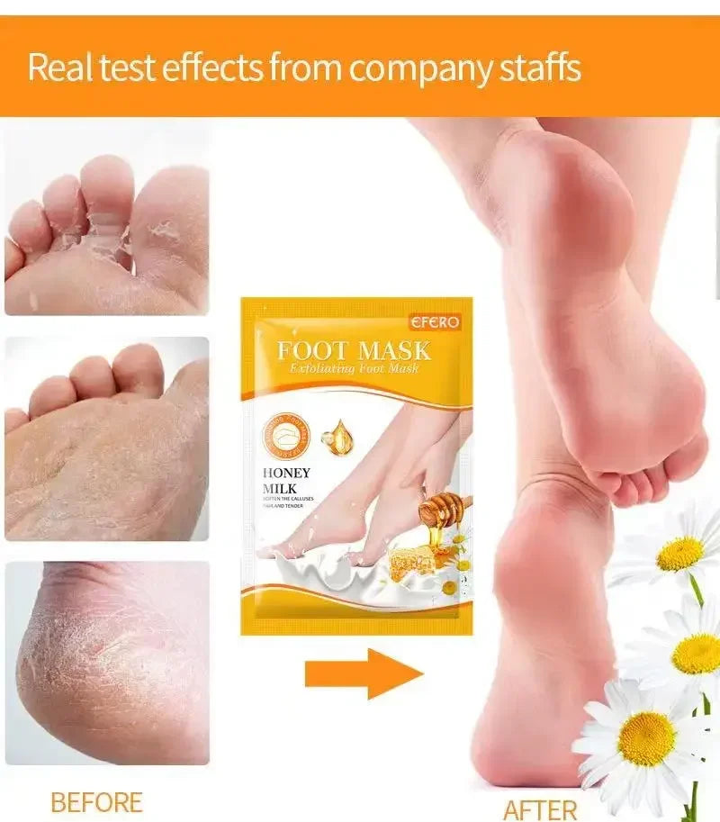 Honey Foot Mask – 1 Pair for Dead Skin & Callus Removal, Exfoliating Foot Treatment, Whitening Foot Spa & Skin Care Tool