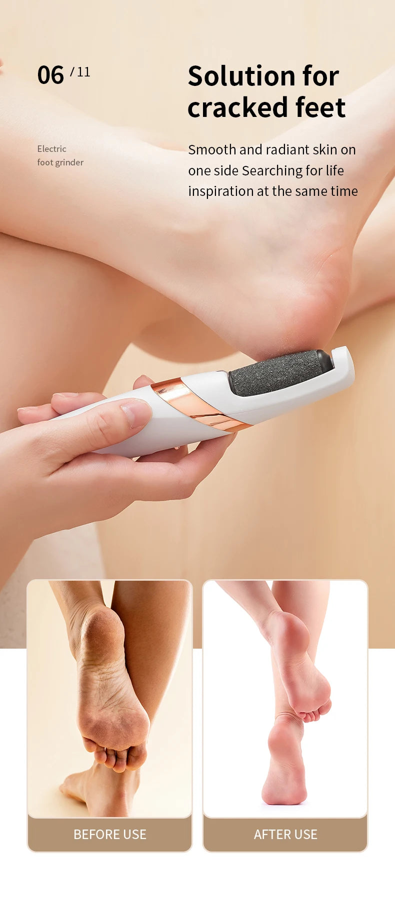 HOMFISH Electric Foot Grinder – Automatic Callus Remover Pedicure Machine for Smooth and Beautiful Feet