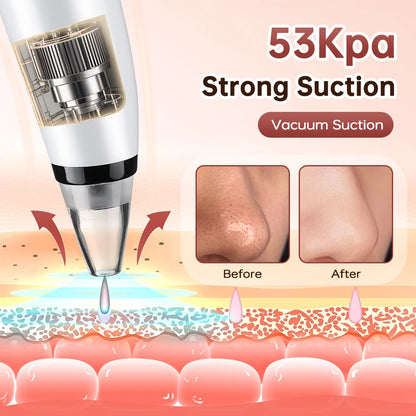 3-Mode Blackhead Remover Vacuum – Facial Pore Cleaner & Dead Skin Removal Beauty Tool