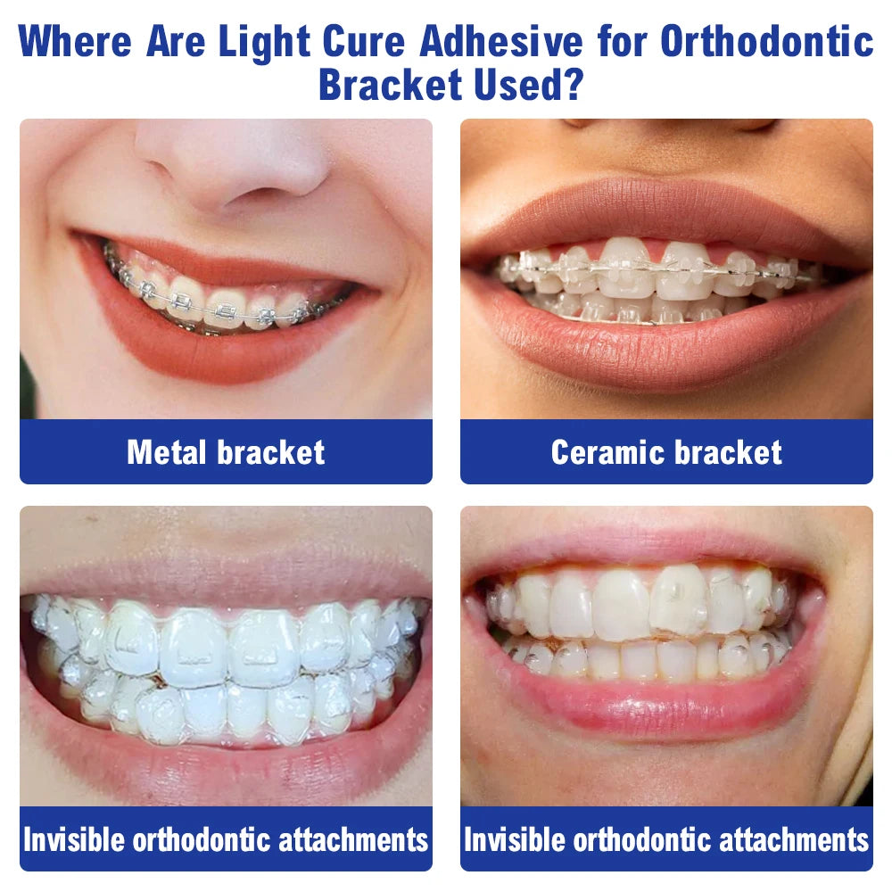 Dental Orthodontic Adhesive Kit — Light Cure Glue for Metal & Ceramic Brackets, Invisible Bonding Dentistry Tools
