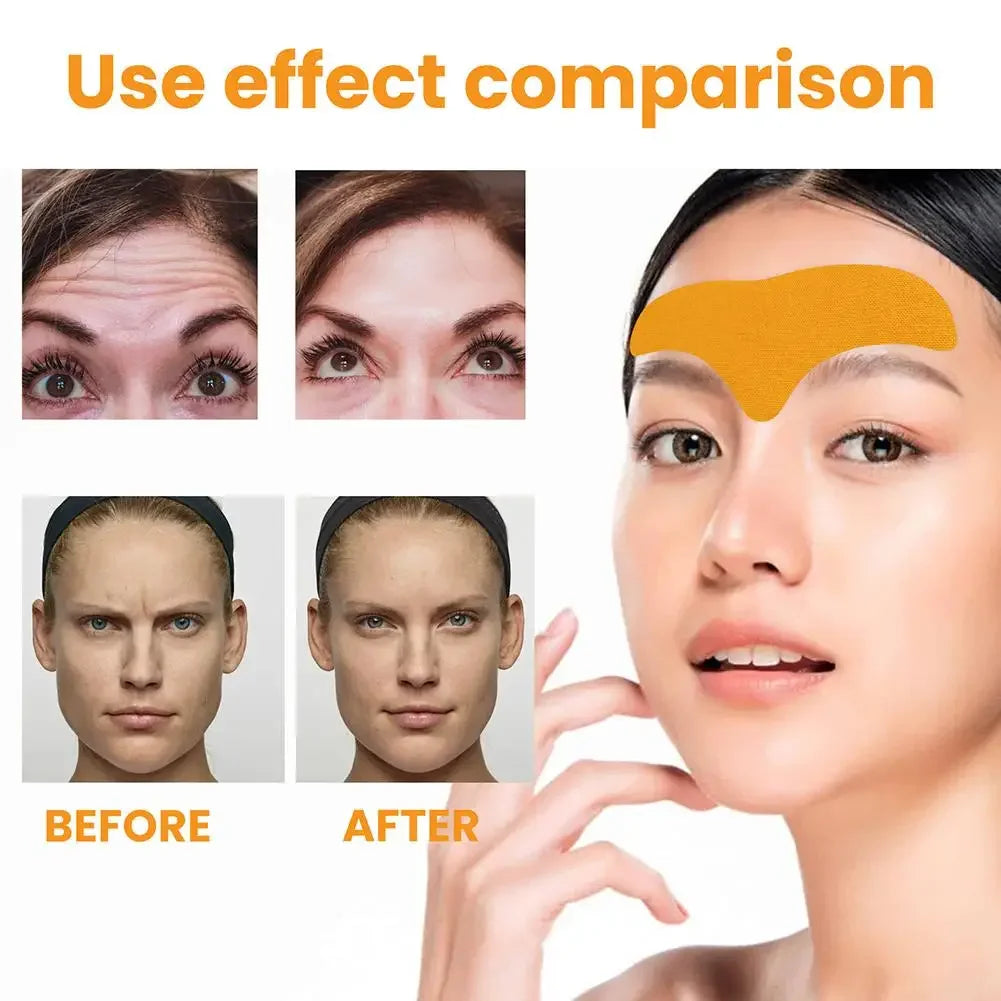 10-100pcs Forehead Wrinkle Patches — Anti-Wrinkle Gel Skin Care Patches for Natural Forehead Line Removal