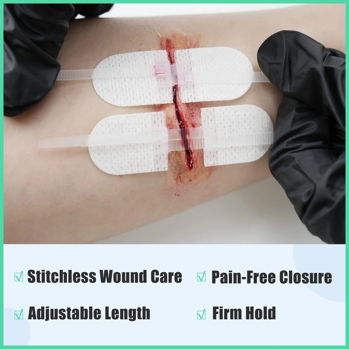 RHINO RESCUE Zip Stitch Laceration Closure Kit — Wound Closure Strips with Dressings, Suture-Free Care