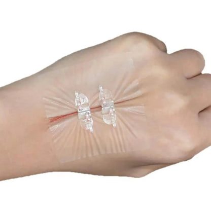 Camping Wound Closure Strips – Painless Adhesive Suture Patch for Fast Hemostatic Care & First Aid