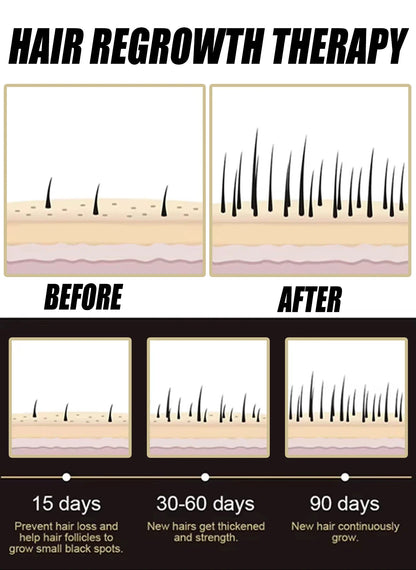2026 Anti Hair Loss Essence for Scalp Care, Hair Growth Support & Improved Scalp Health