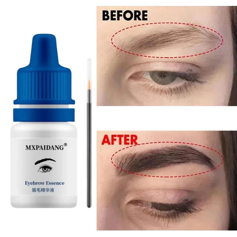 Fast Eyebrow & Eyelash Growth Serum – Hair Loss Prevention, Thicker Fuller Brows & Lashes Enhancer
