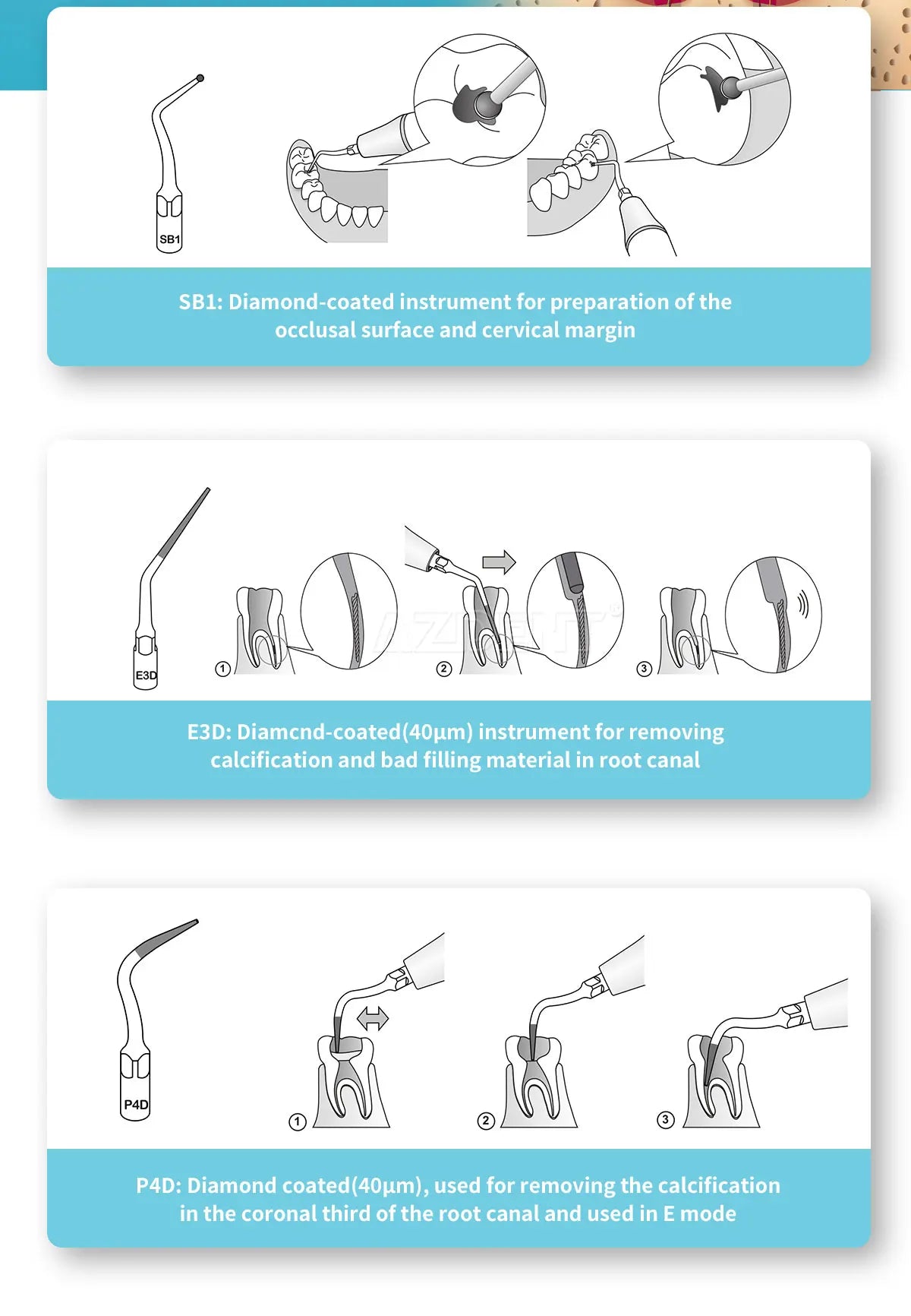 AZDENT 5pcs Dental Scaler Tips – Compatible with EMS, WOODPECKER, SATELEC, DTE, NSK Ultrasonic Scalers