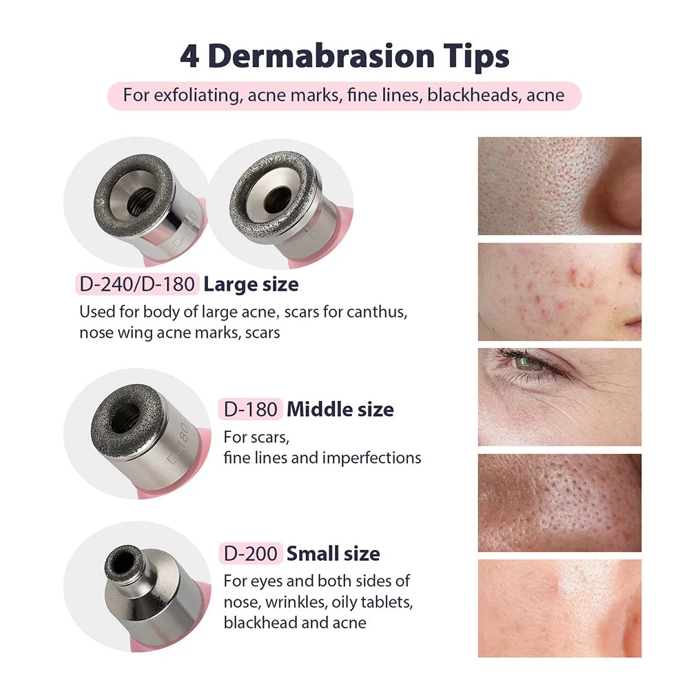 Foreverlily Portable Diamond Peeling Machine – Microdermabrasion Facial Cleaner & Blackhead Remover Vacuum Device