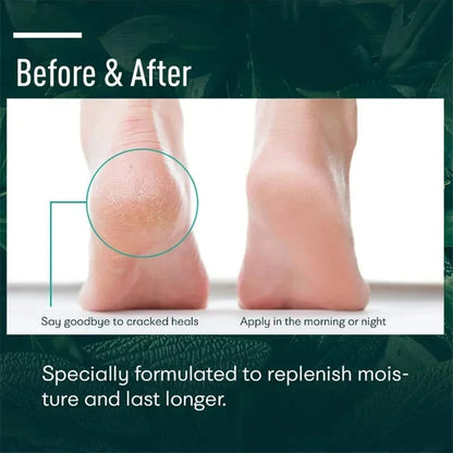 Herbal Heel Repair Foot Cream – Cracked Heel Care, Dead Skin Exfoliation & Deep Moisturizing for Soft, Smooth Feet