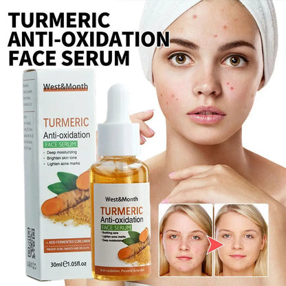 Turmeric Brightening Facial Serum – Antioxidant Skin Care & Dark Spot Corrector (1/2/3-Piece Set)