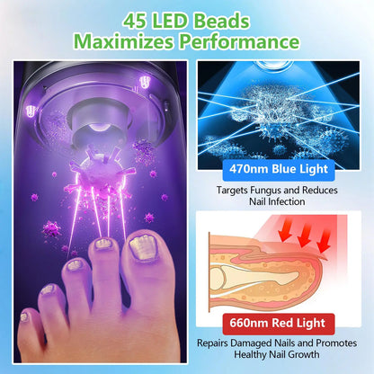 Laser Nail Fungus Treatment Device – Dual 15x470nm Blue & 30x650nm Red Light with Digital Display Nail Care System