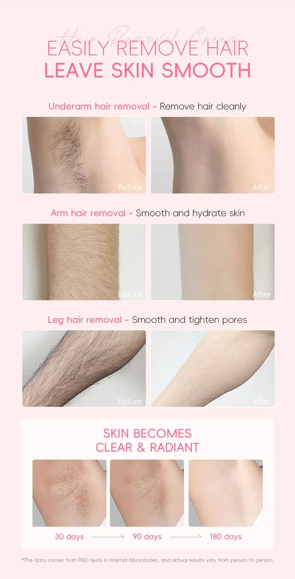 LAIKOU Hair Removal Cream for Men & Women — Painless Body & Intimate Area Epilator with Hair Growth Inhibitor, 50g