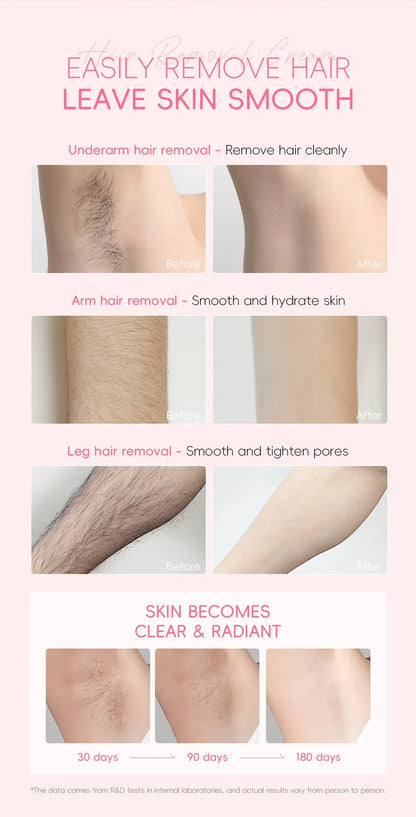 LAIKOU Hair Removal Cream for Men & Women — Painless Body & Intimate Area Epilator with Hair Growth Inhibitor, 50g