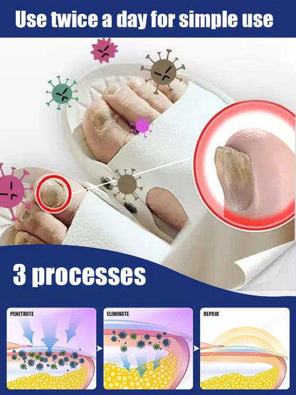 Quick Fungal Nail Treatment — Fast-Acting Solution to Say Goodbye to Nail Fungal Worries