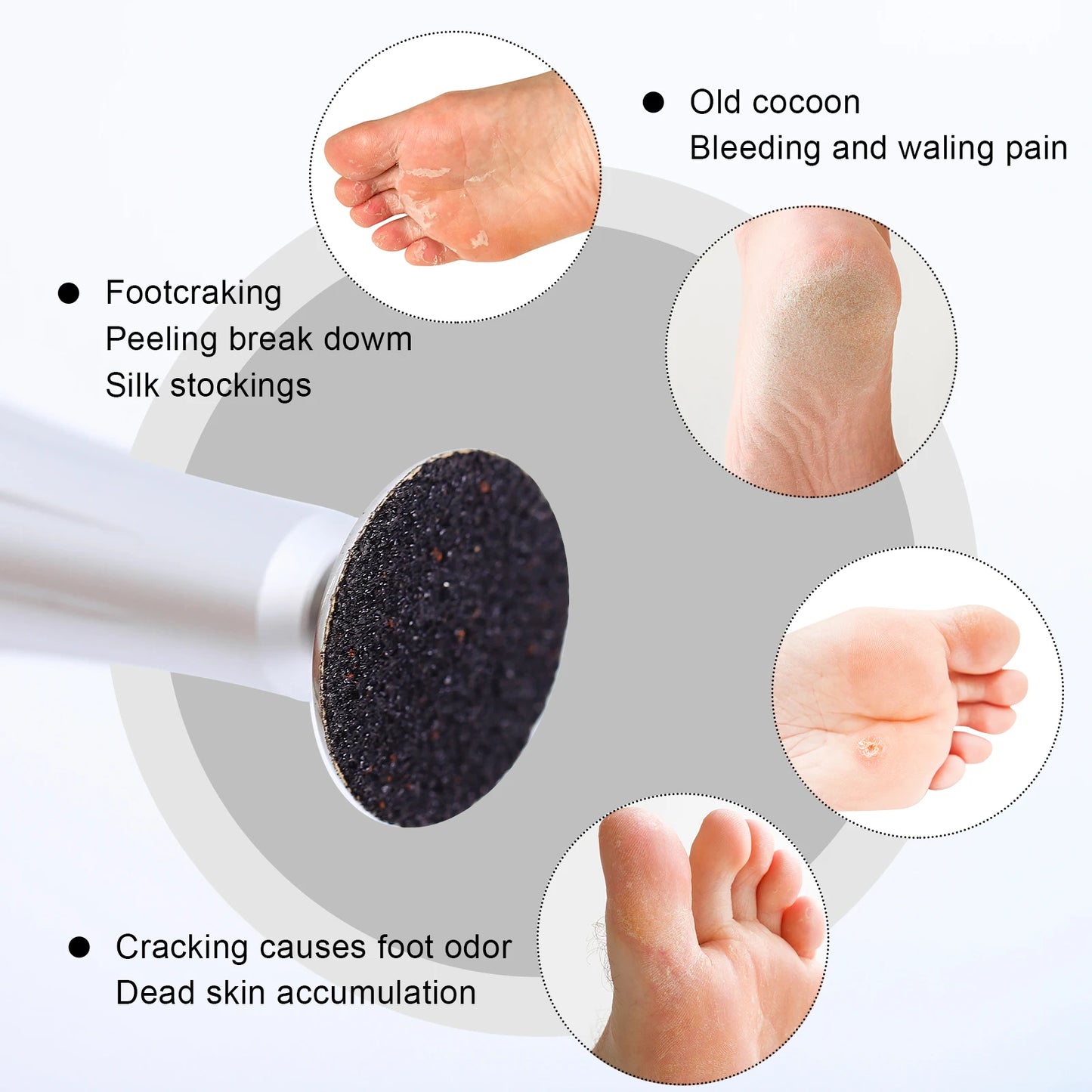 Foot Dead Skin Sandpaper Smart Wheel Pedicure Disc | Replaceable Sandpaper for Callus and Cuticle Removal | 25MM Manicure Tool