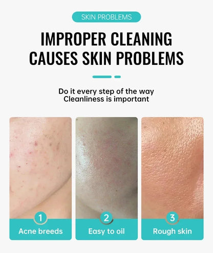 Effective Acne Removal Cream – Anti-Acne Gel for Redness, Pimples, Deep Pore Cleaning & Oil Control Skin Care