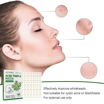 144 Pack Acne Pimple Patches – Translucent Matte Hydrocolloid with Salicylic Acid & Tea Tree Oil for Whiteheads & Inflamed Acne
