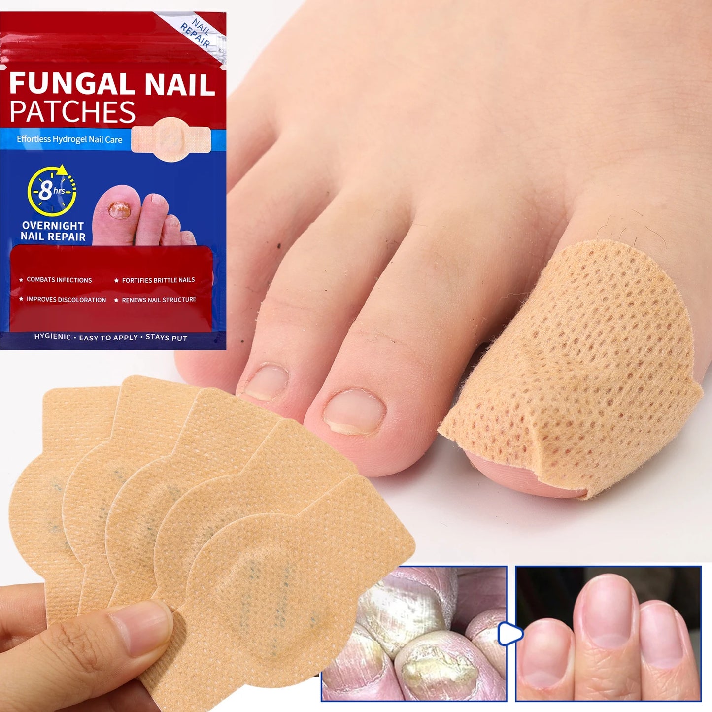 21/105pcs Waterproof Nail Fungus Repair Patches — Ingrown Nail Correction Stickers for Damaged Nail & Feet Care