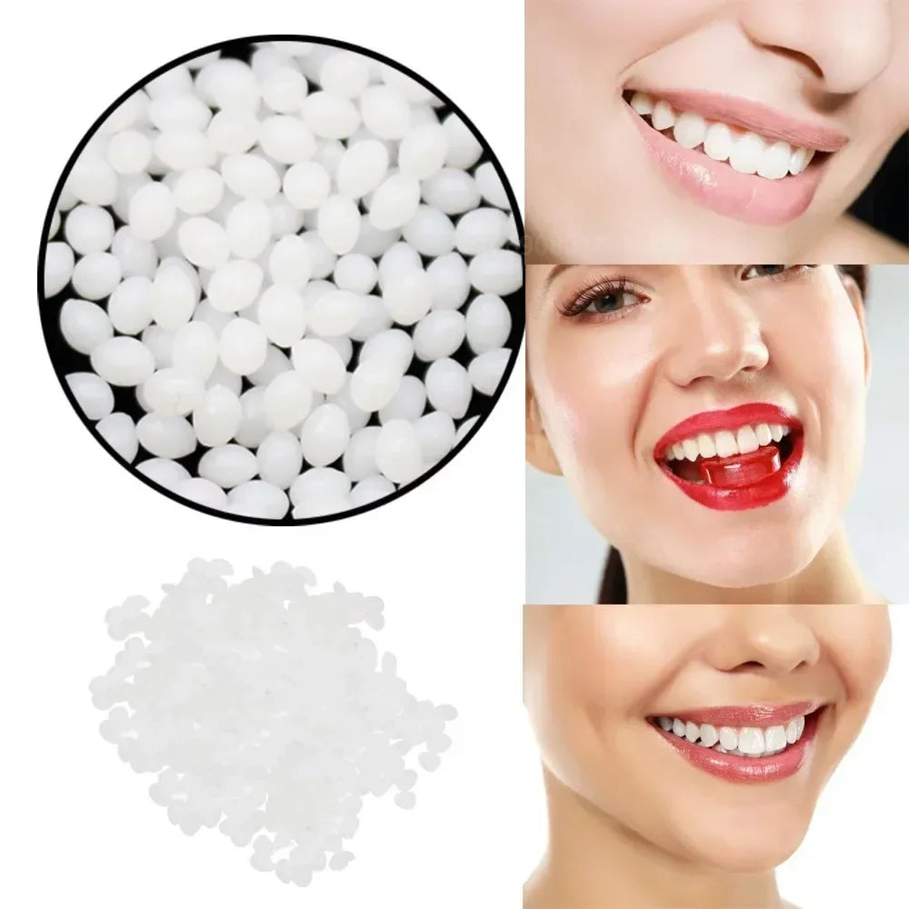 Temporary Tooth Repair Beads – Food Grade Dental Filling Material for Missing or Broken Teeth, False Teeth Glue, Denture Repair
