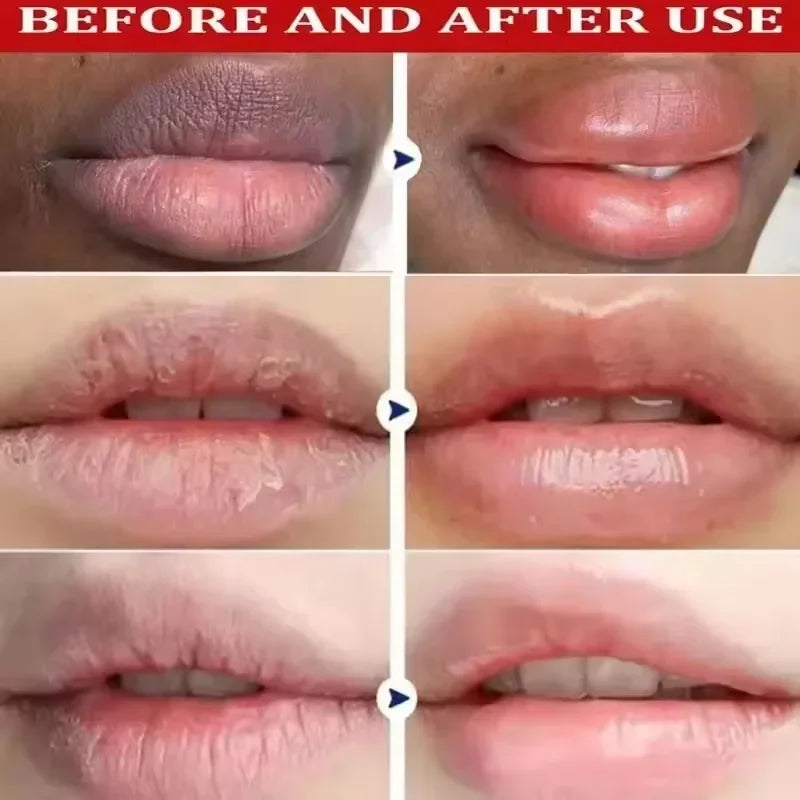Lip Lightening & Repair Lip Mask Serum – Exfoliating Dark Lip Balm for Melanin Reduction, Hydration & Smooth Lip Care Treatment