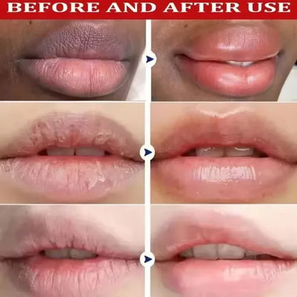 Lip Lightening & Repair Lip Mask Serum – Exfoliating Dark Lip Balm for Melanin Reduction, Hydration & Smooth Lip Care Treatment