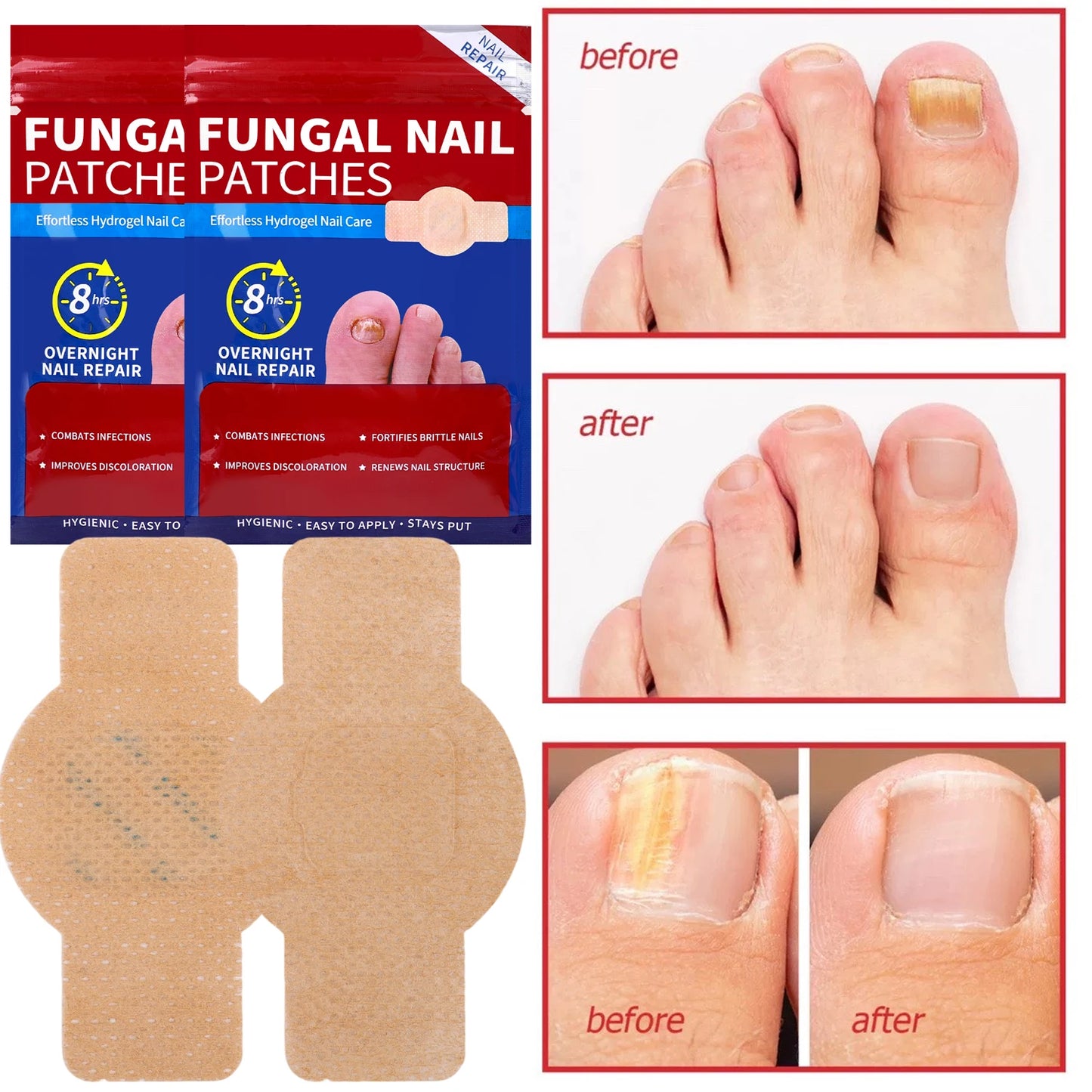 21/105pcs Waterproof Nail Fungus Repair Patches — Ingrown Nail Correction Stickers for Damaged Nail & Feet Care