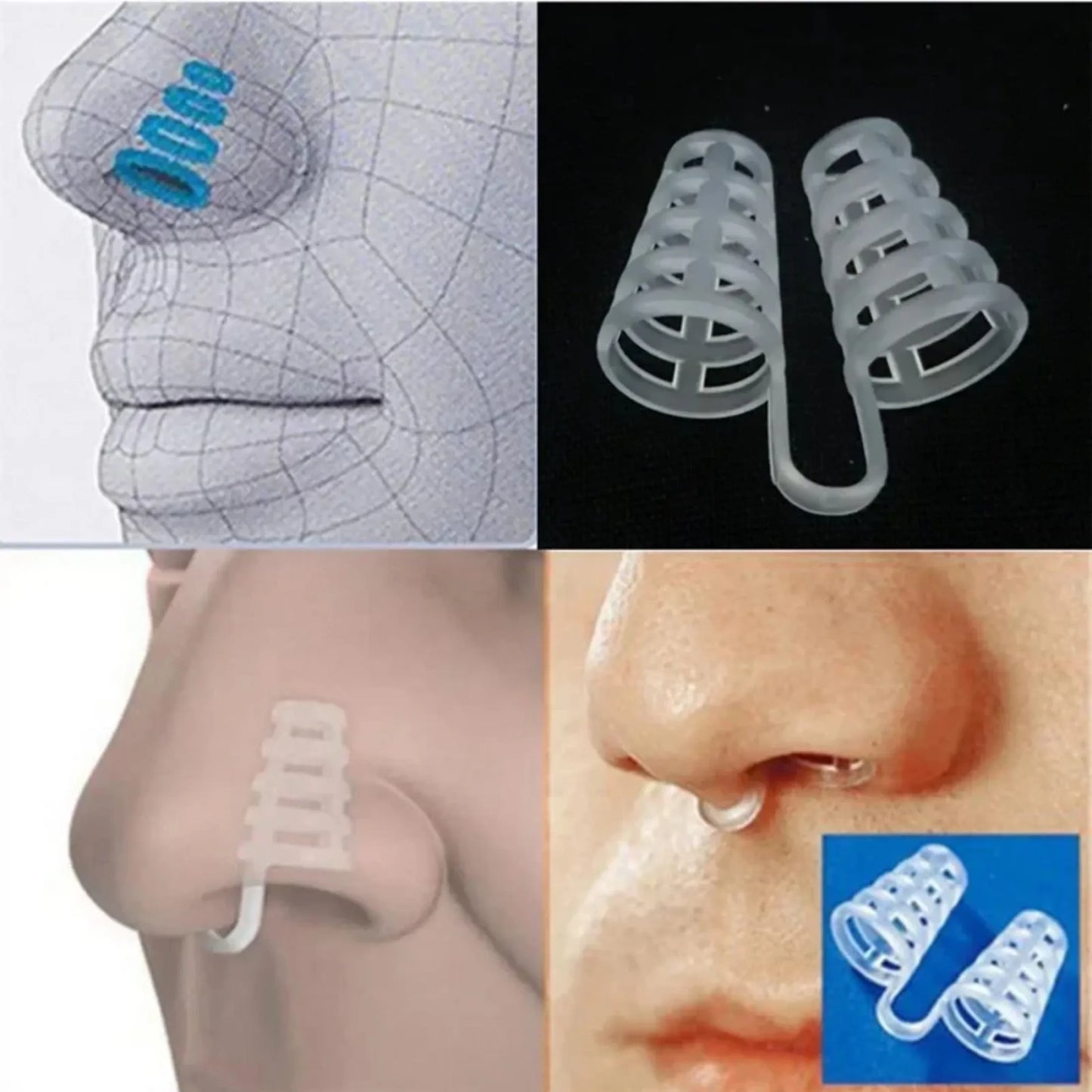 Anti-Snoring Nasal Dilators - Breathe Easy Sleep Aid Cones for Improved Airflow & Congestion Relief