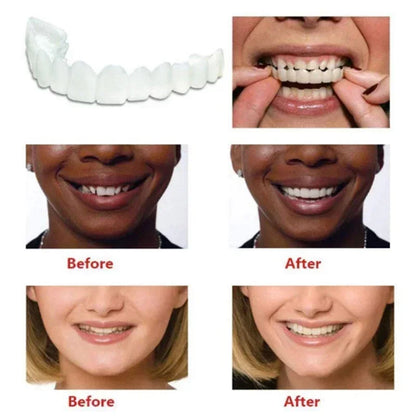 Perfect Fit Snap-On Silicone Smile Veneers - Teeth Whitening Fake Tooth Cover, Upper False Tooth for Oral Hygiene Care