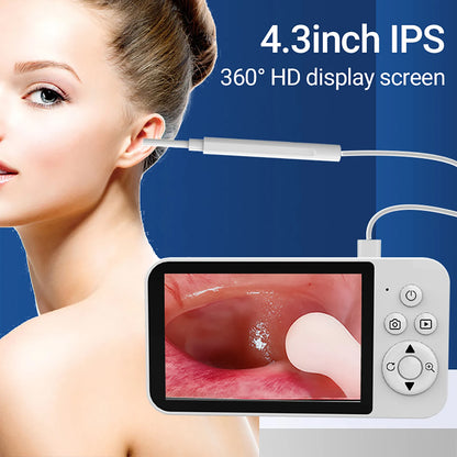 GUANMOU Digital Otoscope – 3.9mm Ear Scope Camera with 6 LED Lights, 4.3" IPS Ear Wax Removal Tool for Kids & Adults