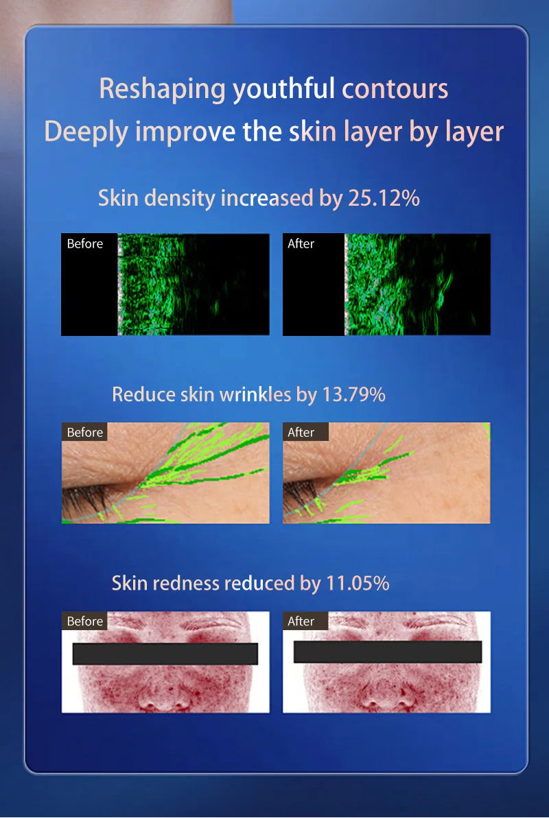 Newest 3 in 1 Multi-Function Facial Lifting, Body Shaping, and Anti-Aging Firming Machine, Skin Rejuvenation and Firming Device