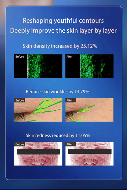 Newest 3 in 1 Multi-Function Facial Lifting, Body Shaping, and Anti-Aging Firming Machine, Skin Rejuvenation and Firming Device