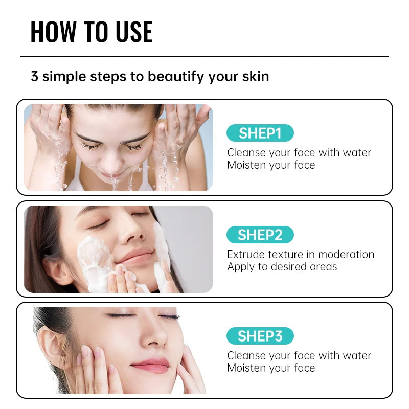 Salicylic Acid Acne Removal Cream – Anti-Acne, Redness Repair, Deep Cleaning & Oil Control Skincare