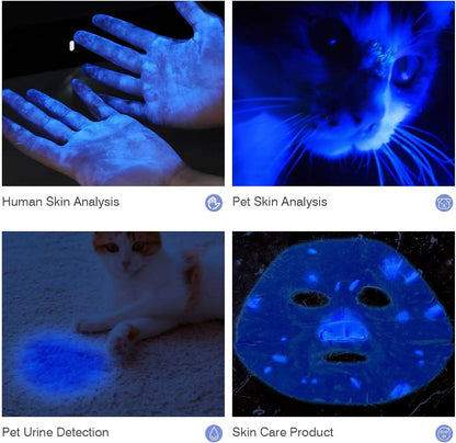Wireless Wood's Lamp Skin Analyzer – UV Magnifying Device for Facial Beauty & Skin Analysis