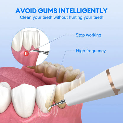 Ultrasonic Dental Plaque & Calculus Remover – Teeth Tartar Eliminator, Stains Cleaner, Electric Tooth Stone Scaler