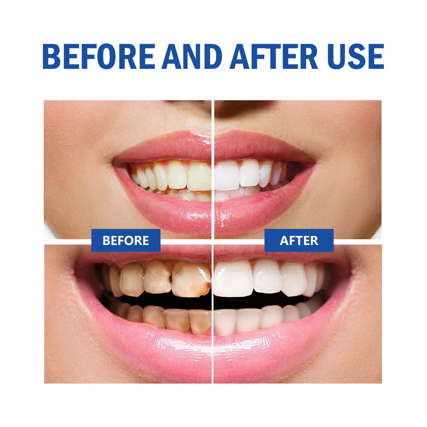 Sip-4 Probiotic Whitening Toothpaste — Stain Removal, Brightening & Fresh Breath Formula