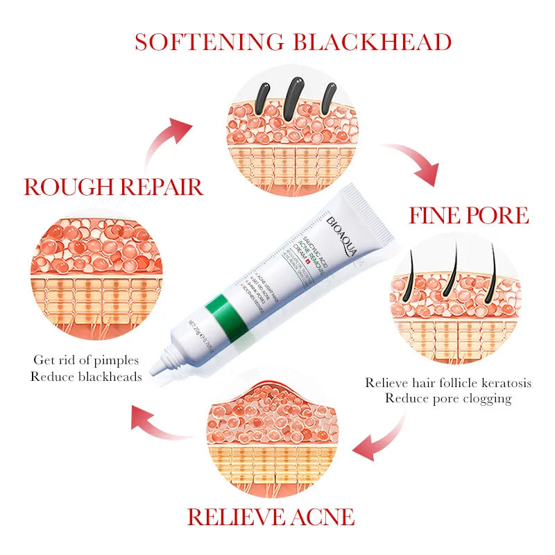 BIOAQUA Salicylic Acid Face Cream - Acne Treatment Moisturizing Cream for Blackhead Removal, Skin Repair & Firming Care