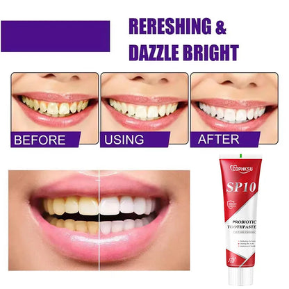 SP-10 Fresh Breath & Whitening Toothpaste – Removes Plaque, Yellow Stains & Supports Gum Health for Oral Care
