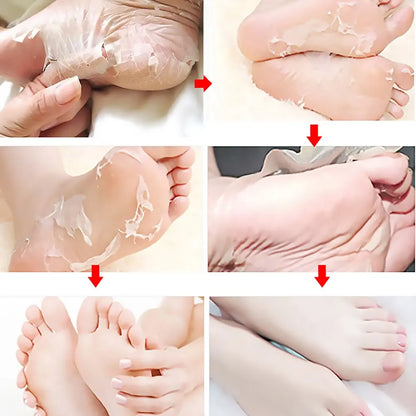 FlowWeek Exfoliating Foot Mask – Removes Dead Skin, Calluses & Dry, Chapped Feet for Smooth, Soft Skin