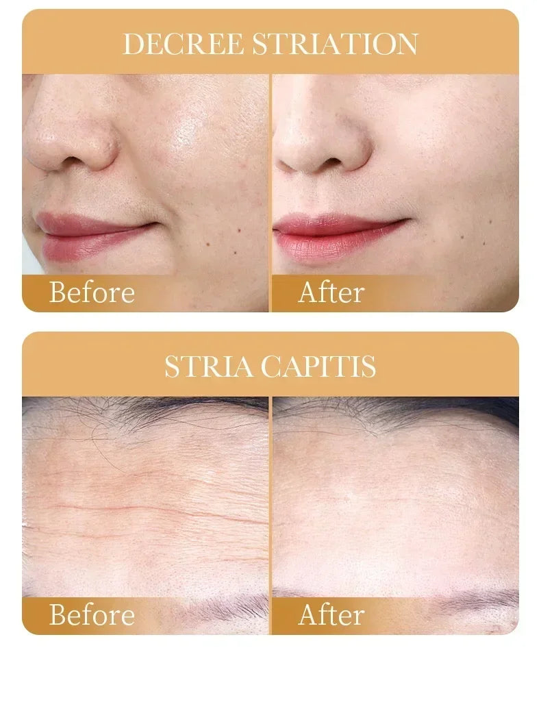 10pcs SADOER Collagen Face Masks – Anti-Wrinkle, Moisturizing & Brightening Skincare