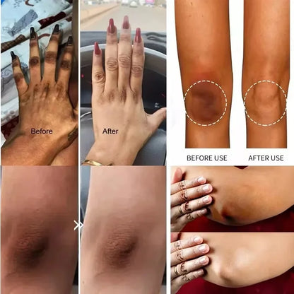 Whitening Cream for Private Parts – Underarm, Inner Thigh & Knee Brightening Serum